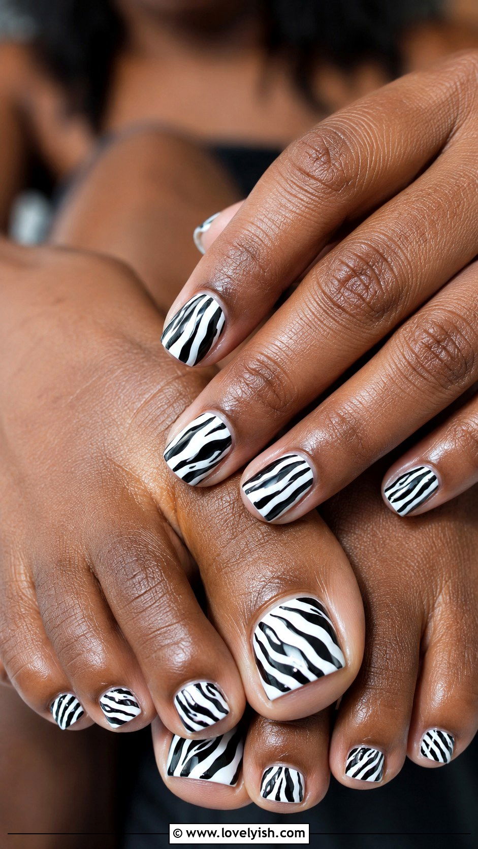 Glossy Zebra Print Pedicure - 50 summer pedicure - 50 summer pedicure